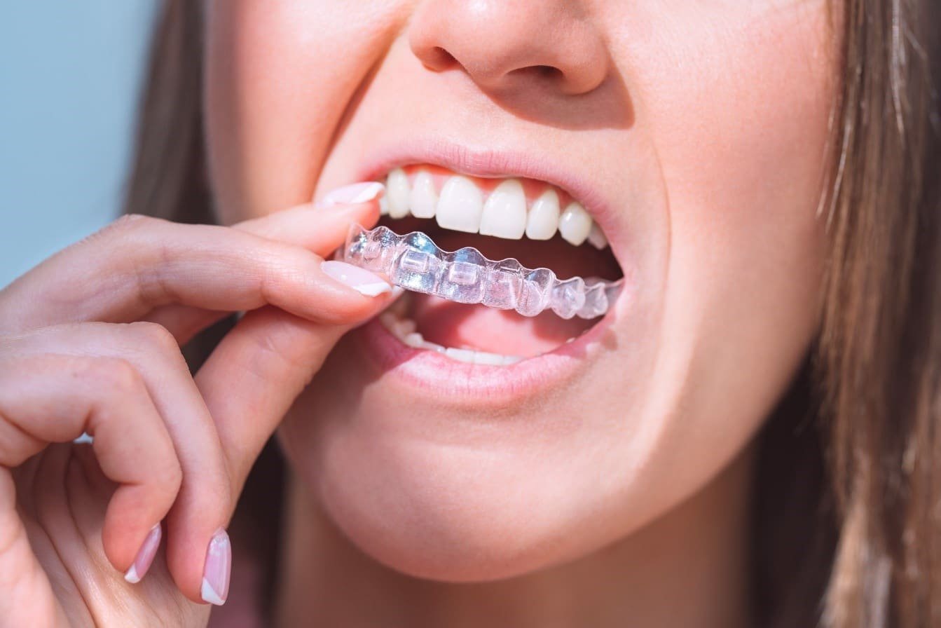 Invisalign doctor site login