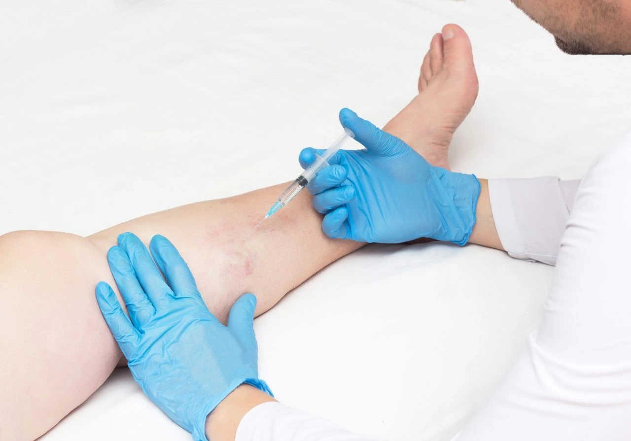 vein clinics in New York
