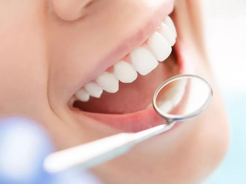 Teeth Whitening