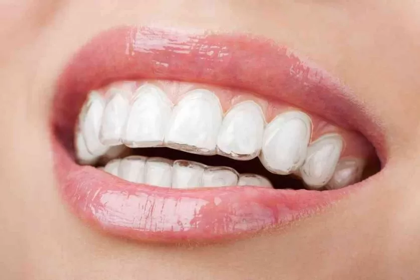 Invisalign doctor