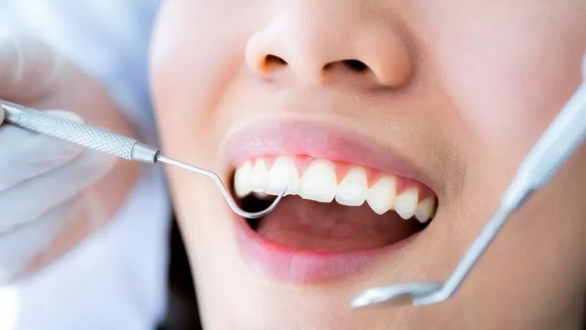 dental deep cleaning