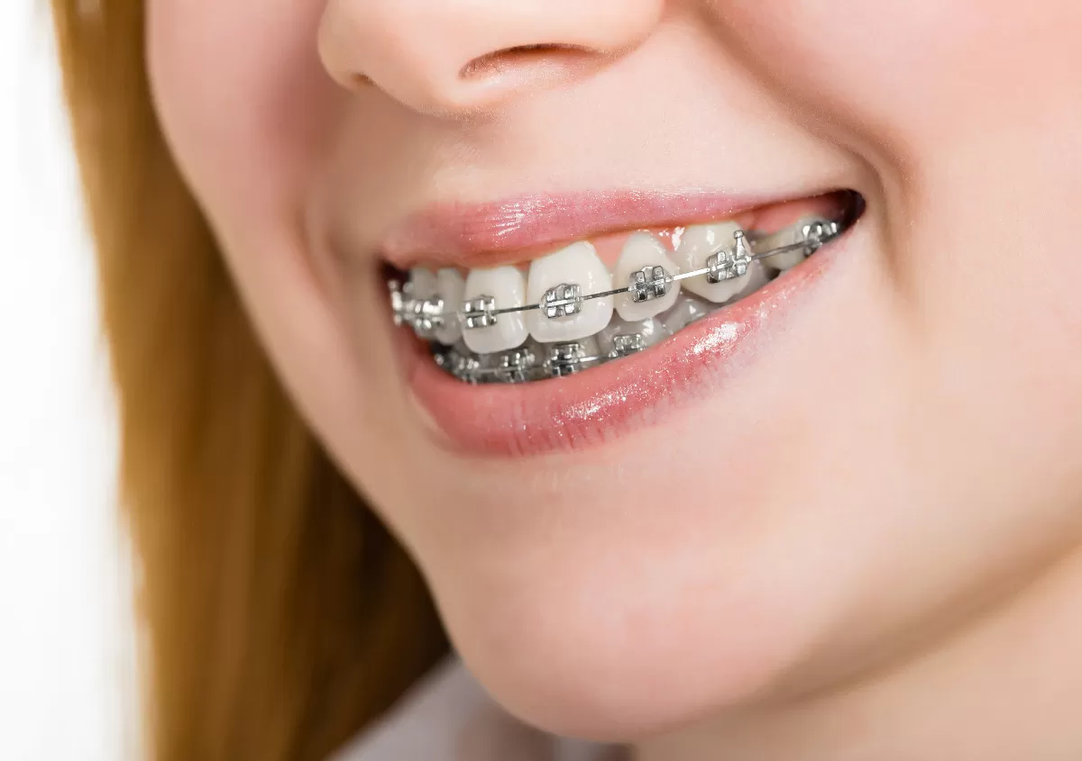 orthodontist in north miami